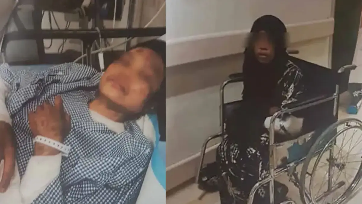 Kolase foto kondisi LY, TKW asal Jampangtengah, Kabupaten Sukabumi yang diduga menjadi korban kekerasan majikannya di Arab Saudi. (Sumber : Istimewa)